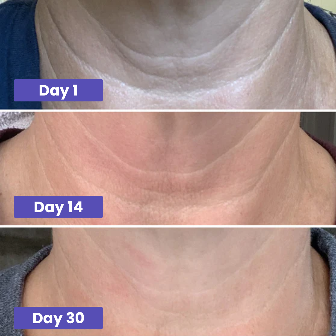Tighten & Lift - Neck Cream